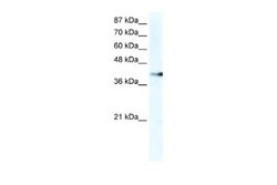 ZNF556 Rabbit anti-Human, Polyclonal, Novus Biologicals 0.1 mL | Buy Online | Novus Biologicals | Fisher Scientific